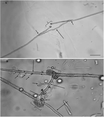 Fungicides With Contrasting Mode of Action Differentially Affect Hyphal Healing Mechanism in Gigaspora sp. and Rhizophagus irregularis